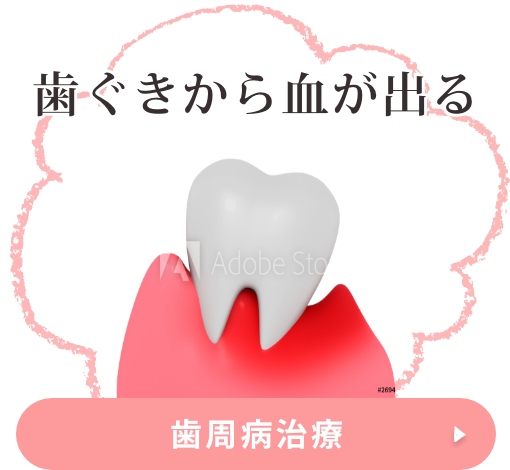 歯周病治療
